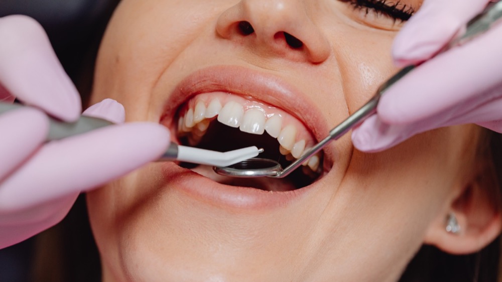 Periodoncia en Sitges | Tratamiento de encías